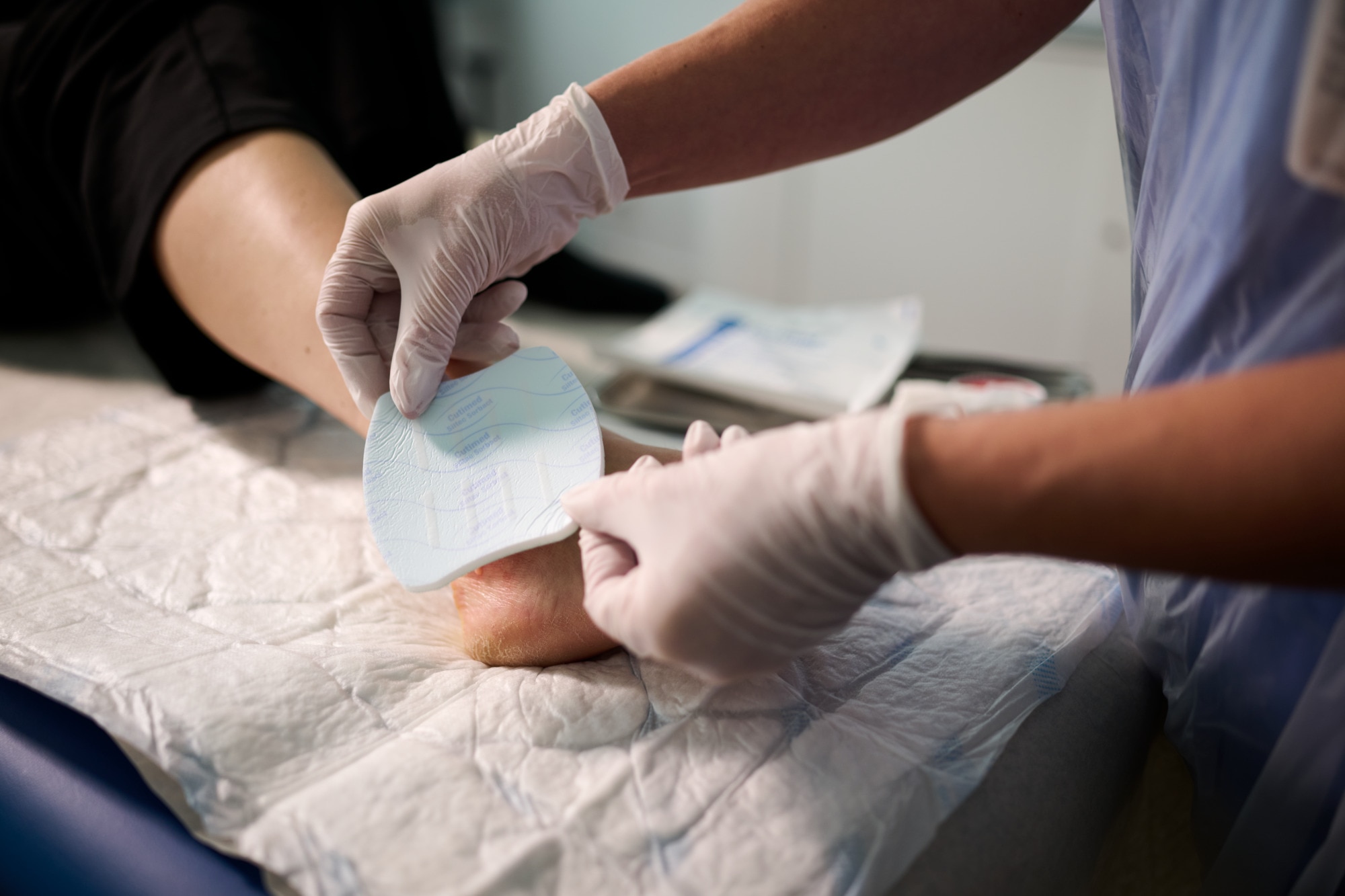 Medical Treatment Foot