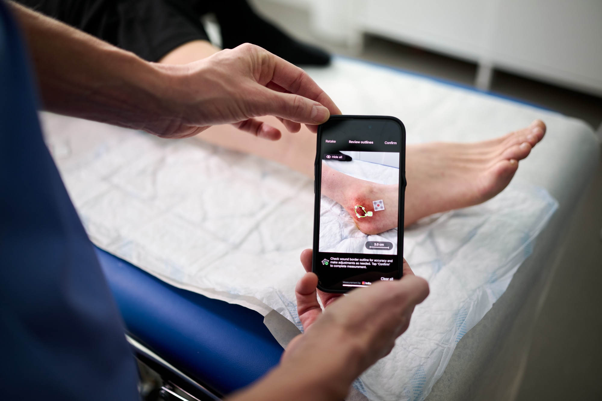 Phone Capturing Wound Foot